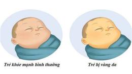ảnh chụp màn hình bé bị vàng da mẹ ăn trứng ga được không