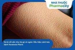 ảnh chụp màn hình bệnh sần sùi như da gà