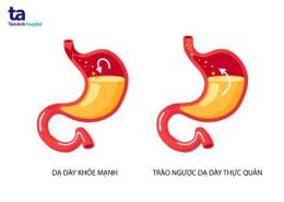 ảnh chụp màn hình bị trào ngược dạ dày ăn trứng gà được không
