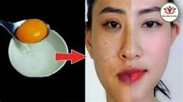 ảnh chụp màn hình cách làm trắng da với trứng gà