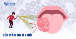 ảnh chụp màn hình chữa sùi mào gà ở bệnh viện da liễu tp hcm