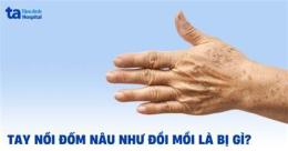 ảnh chụp màn hình da cánh tay nổi nhiều vết giống như da gà