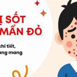 bé sốt nhưng nổi da gà