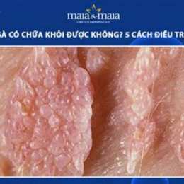 bệnh viện da liễu có chữa sùi mào gà không