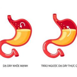 bị trào ngược dạ dày ăn thịt gà được không