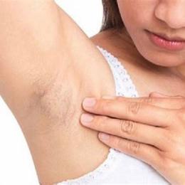 cách làm cho nách hết da gà