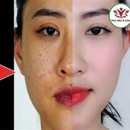 cách làm trắng da với trứng gà