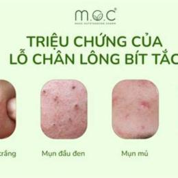 cách trị nổi da gà