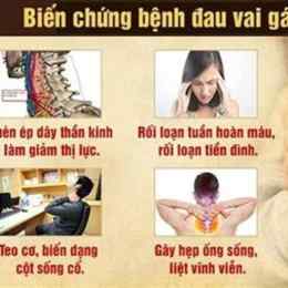 căng cơ cổ vai gây đau đầu