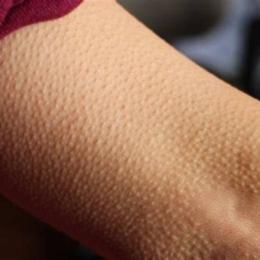 da gà có collagen