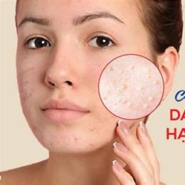 da nổi sần sùi như da gà