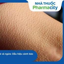 da tay nổi sần như da gà