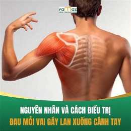 đau vai gáy lan lên đầu