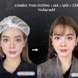 diễn đàn gái gọi