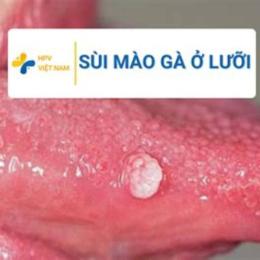 gà không lưỡi đá như the nào