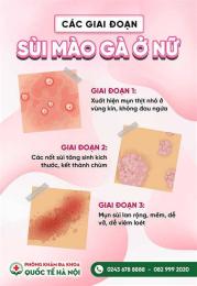 giao diện app ai đã chữa khỏi bệnh sùi mào gà
