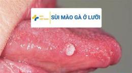 giao diện app chữa sùi mào gà ở bệnh viện da liễu tp hcm