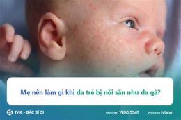 giao diện app da bé nổi như da gà