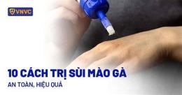 hướng dẫn sử dụng benh vien da lieu tri sui mao ga