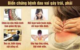 hướng dẫn sử dụng căng cơ cổ vai gây đau đầu