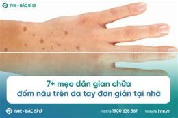 hướng dẫn sử dụng da cánh tay nổi nhiều vết giống như da gà