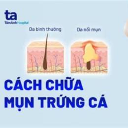 làm sao để hết nổi da gà