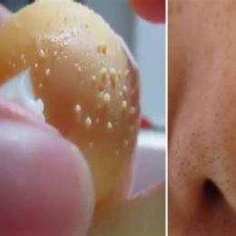 lột da mặt bằng trứng gà