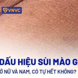 mào gà đá