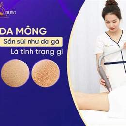 mông bị sần da gà
