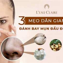 mụn đầu đen mũi gần