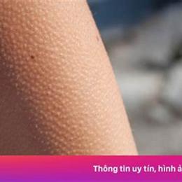 tại sao có hiện tượng nổi da gà