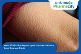 tính năng nổi bật bị nổi da gà và ngứa