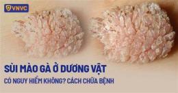 tính năng nổi bật cách chữa bệnh da gà