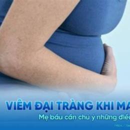 trang mang da ga