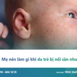 trẻ bị nổi da gà