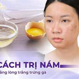 trị nám da bằng lòng trắng trứng gà